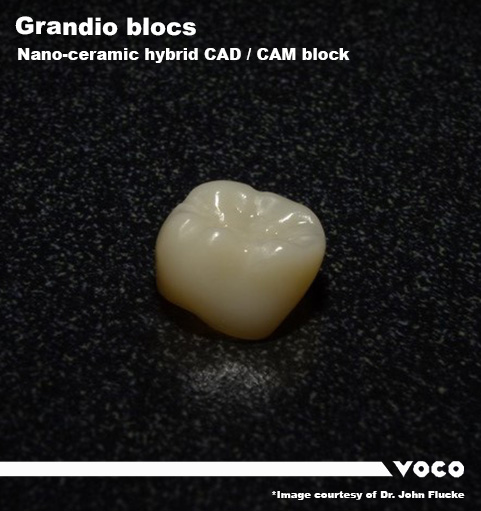 Grandio blocs Flucke v3