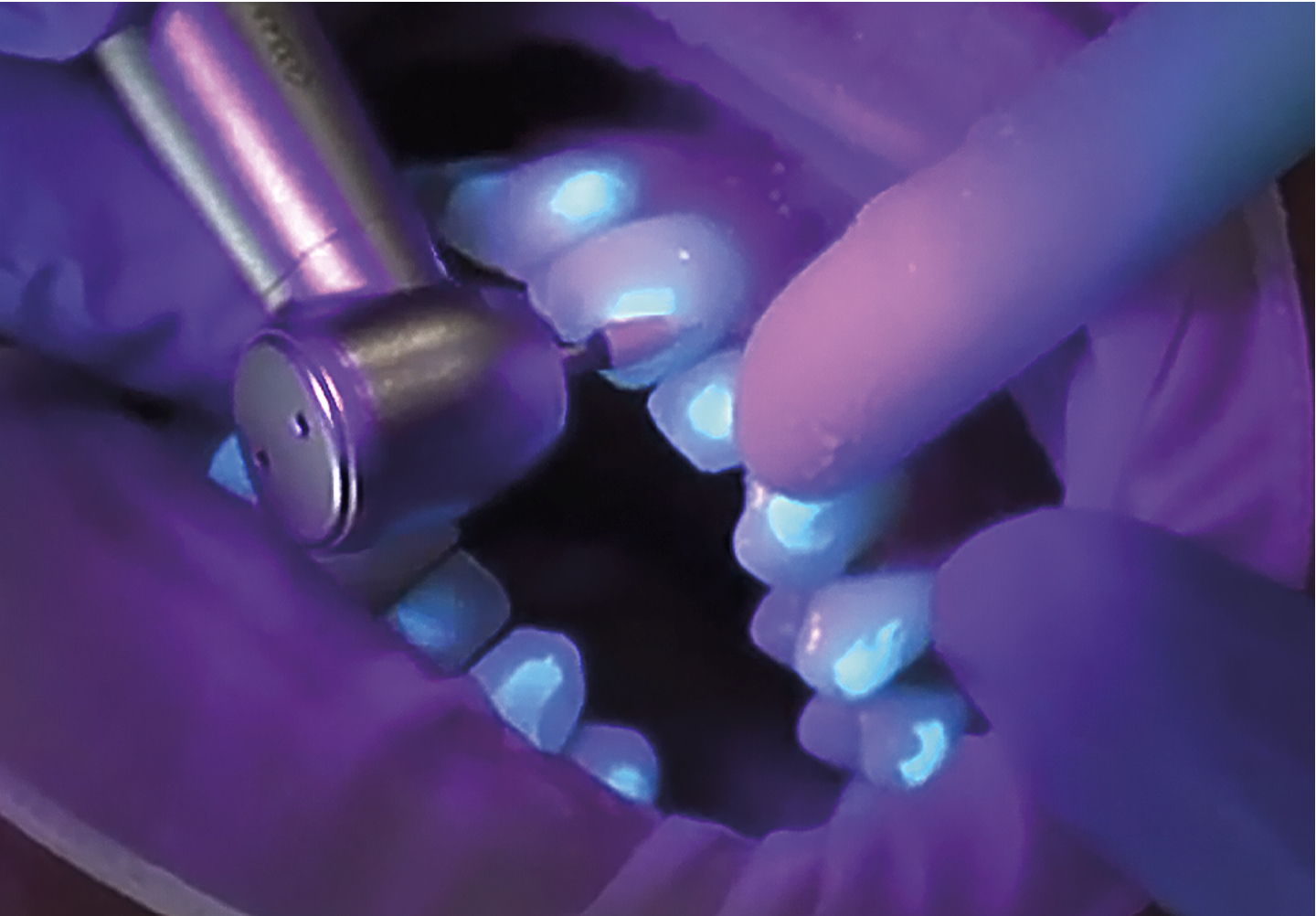 Fluorescent Removal